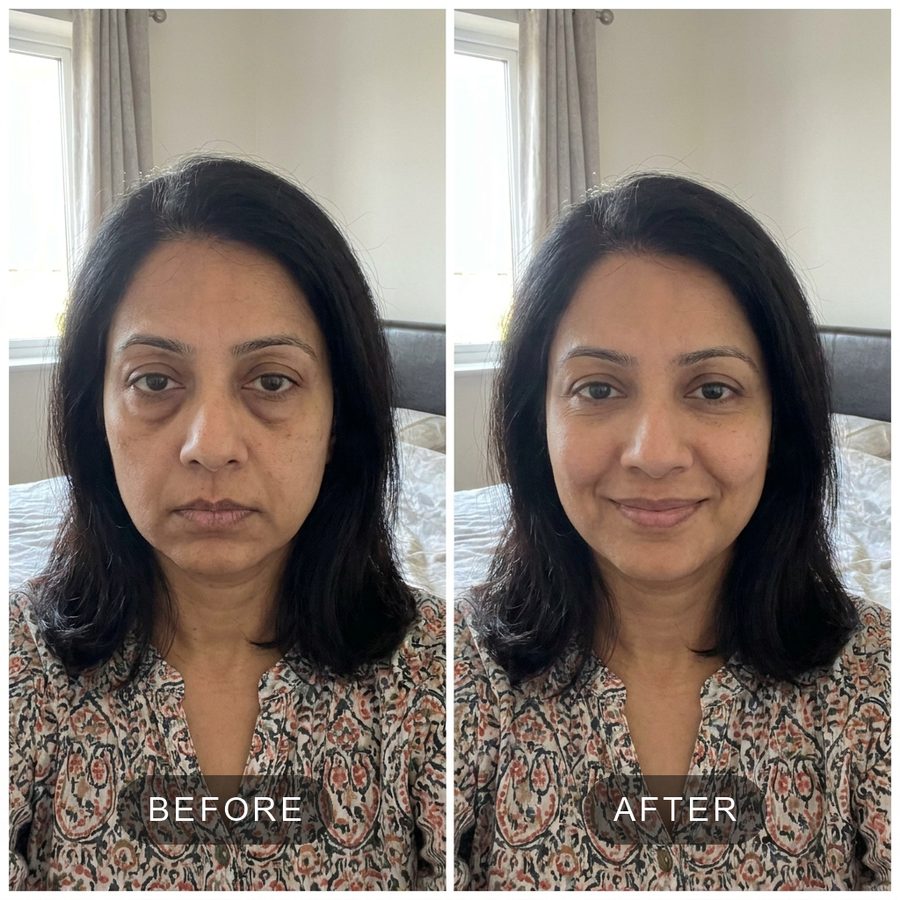 before and after