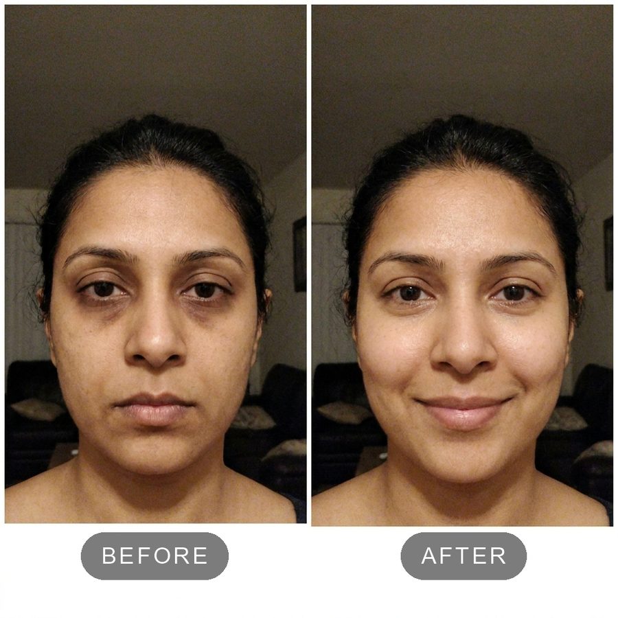 before and after