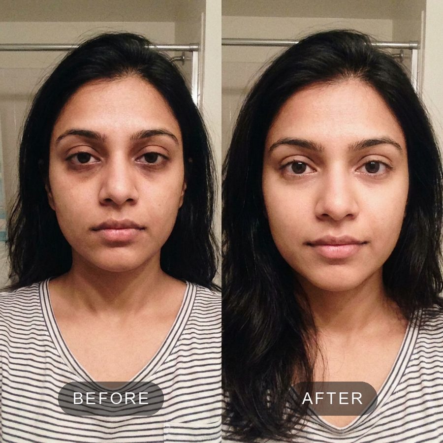 before and after