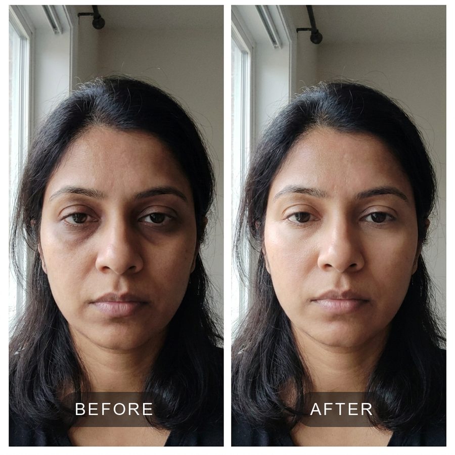 before and after